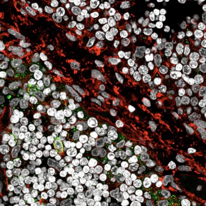 Münchner Forscher entschlüsseln neuartigen Mechanismus des Immunsystems